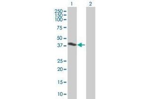 Lane 1: AIM2 transfected lysate ( 39. (AIM2 293T Cell Transient Overexpression Lysate(Denatured))