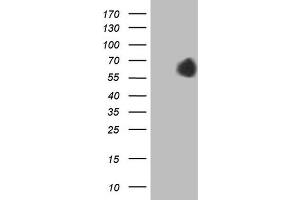 Western Blotting (WB) image for anti-alpha-Fetoprotein (AFP) (AA 19-397) antibody (ABIN2716010)