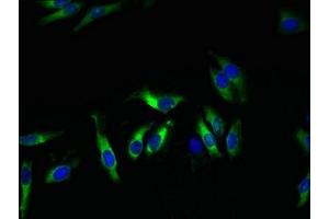Immunofluorescence (IF) image for anti-Potassium Voltage-Gated Channel, Shal-Related Subfamily, Member 1 (Kcnd1) (AA 410-647) antibody (ABIN7163973)