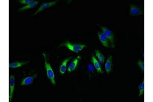 Immunofluorescent analysis of Hela cells using ABIN7163973 at dilution of 1:100 and Alexa Fluor 488-congugated AffiniPure Goat Anti-Rabbit IgG(H+L) (KCND1 Antikörper  (AA 410-647))