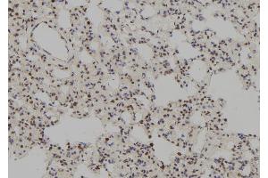 ABIN6277698 at 1/100 staining Rat lung tissue by IHC-P.