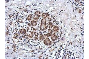 Image no. 1 for anti-Zinc Finger and BTB Domain Containing 20 (ZBTB20) (AA 1-668) antibody (ABIN1501916) (ZBTB20 Antikörper  (AA 1-668))