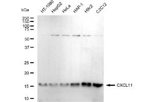 Western blotting analysis using CXCL11 antibody (ABIN7798044).