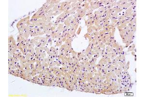 Formalin-fixed and paraffin embedded rat heart tissue labeled with Anti-ERK4 Polyclonal Antibody, Unconjugated (ABIN754288) at 1:200 followed by conjugation to the secondary antibody and DAB staining (MAPK7 Antikörper  (AA 401-500))