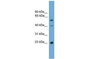 WB Suggested Anti-WBP4 Antibody Titration: 0. (WBP4 Antikörper  (N-Term))