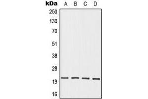 Western blot analysis of OAZ3 expression in HEK293T (A), Jurkat (B), mouse testis (C), rat testis (D) whole cell lysates.