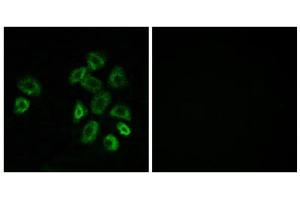 Immunofluorescence analysis of MCF-7 cells, using GPRC5B antibody.