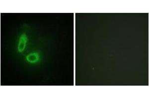 Immunofluorescence analysis of HeLa cells, using EFNA1 Antibody. (Ephrin A1 Antikörper  (AA 66-115))
