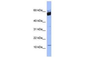 Image no. 1 for anti-S100 Calcium Binding Protein A9 (S100A9) (N-Term) antibody (ABIN6741664) (S100A9 Antikörper  (N-Term))