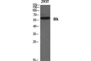 Western Blotting (WB) image for anti-B Lymphoid Tyrosine Kinase (BLK) (Ser180) antibody (ABIN3183520)
