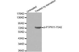 Western blot analysis of extracts from 293 cells using Phospho-PTPN11-Y542 antibody. (PTPN11 Antikörper  (pTyr542))