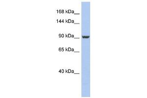 PMS2 antibody used at 1 ug/ml to detect target protein. (PMS2 Antikörper)