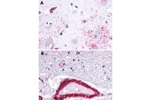 Immunohistochemical staining of formalin-fixed, paraffin-embedded human brain, astrocytes tissue after heat-induced antigen retrieval. (Apelin Receptor Antikörper  (3rd Cytoplasmic Domain))