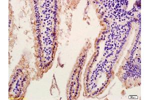 Immunohistochemistry (Paraffin-embedded Sections) (IHC (p)) image for anti-Solute Carrier Family 10 (Sodium/bile Acid Cotransporter Family), Member 2 (SLC10A2) (AA 131-230) antibody (ABIN755143)