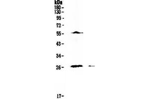 Western blot analysis of IL17 using anti-IL17 antibody .
