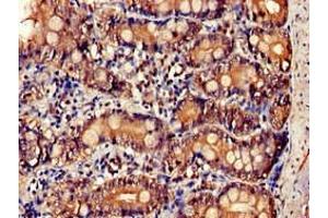Immunohistochemistry of paraffin-embedded human small intestine tissue using ABIN7156899 at dilution of 1:100 (IL-34 Antikörper  (AA 191-240))