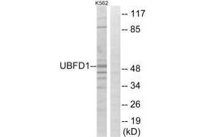 Western blot analysis of extracts from K562 cells, using UBFD1 antibody. (UBFD1 Antikörper)