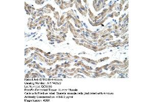 Rabbit Anti-SFRS10 Antibody  Paraffin Embedded Tissue: Human Muscle Cellular Data: Skeletal muscle cells Antibody Concentration: 4. (TRA2B Antikörper  (Middle Region))