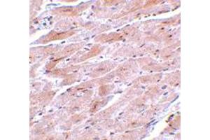 Immunohistochemistry of TRPC3 in mouse heart tissue with TRPC3 polyclonal antibody  at 10 ug/mL . (TRPC3 Antikörper  (N-Term))