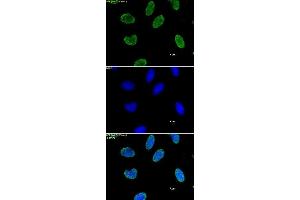 Histone H3 dimethyl Lys9 antibody tested by immunofluorescence.