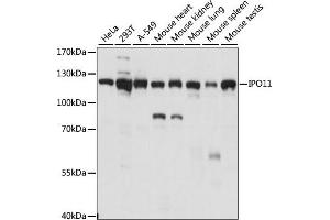 Western blot analysis of extracts of various cell lines, using IPO11 antibody (ABIN7267854) at 1:1000 dilution. (Importin 11 Antikörper  (AA 776-975))
