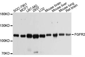 Western blot analysis of extracts of various cell lines, using FGFR2 antibody. (FGFR2 Antikörper)