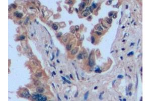 Immunohistochemistry (IHC) image for anti-CD7 (CD7) (AA 26-134) antibody (ABIN7444421)