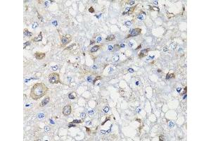 Immunohistochemistry of paraffin-embedded Rat brain using BCS1L Polyclonal Antibody at dilution of 1:100 (40x lens).