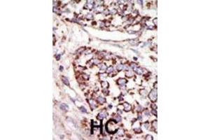 Immunohistochemistry (IHC) image for anti-Mitogen-Activated Protein Kinase 3 (MAPK3) antibody (ABIN3003251)