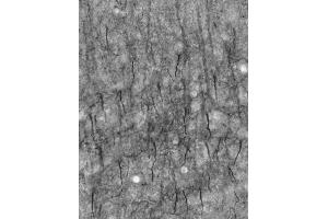 Adult rat cortex immunohistochemistry of axon initial segments. (Ankyrin G Antikörper)