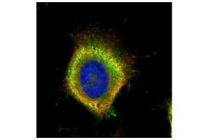 ICC/IF Image Confocal immunofluorescence analysis (Olympus FV10i) of paraformaldehyde-fixed HeLa, using Fatty Acid Synthase, antibody (Green) at 1:500 dilution. (Fatty Acid Synthase Antikörper  (N-Term))