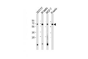 All lanes : Anti-FEM1B Antibody (C-Term) at 1:2000 dilution Lane 1: 293T/17 whole cell lysate Lane 2: mouse testis lysate Lane 3: MCF-7 whole cell lysate Lane 4: rat testis lysate Lysates/proteins at 20 μg per lane. (FEM1B Antikörper  (AA 547-579))