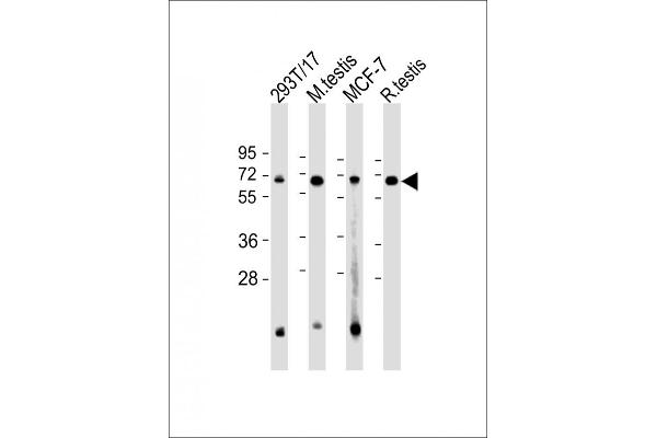 FEM1B Antikörper  (AA 547-579)