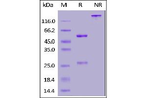Anti-SARS-CoV-2 Spike RBD Antibody, Chimeric mAb, Human IgG1 (ABIN6953206) on SDS-PAGE under reducing (R) and non-reducing (NR) conditions. (SARS-CoV-2 Spike S1 Antikörper)