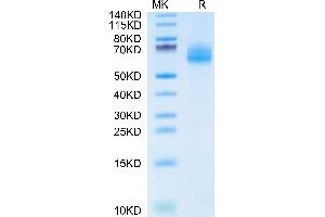 IL18R1 Protein (AA 22-329) (His tag)