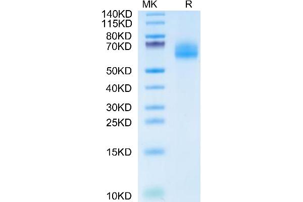 IL18R1 Protein (AA 22-329) (His tag)