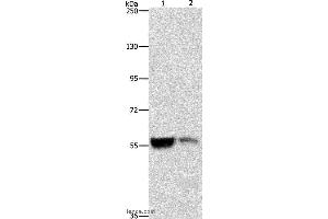 Western blot analysis of Mouse liver and kidney tissue, using ALDH8A1 Polyclonal Antibody at dilution of 1:550 (ALDH8A1 Antikörper)