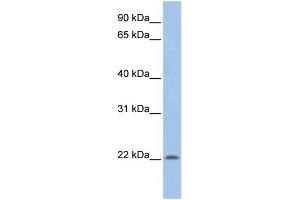 Western Blotting (WB) image for anti-Ubiquitin-Conjugating Enzyme E2M (ube2m) (N-Term) antibody (ABIN2775686)