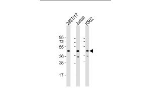 All lanes : Anti-PHF6 Antibody (Center) at 1:2000 dilution Lane 1: 293T/17 whole cell lysate Lane 2: Jurkat whole cell lysate Lane 3: K562 whole cell lysate Lysates/proteins at 20 μg per lane. (PHF6 Antikörper  (AA 148-180))