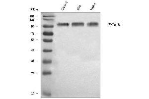 Western blot analysis of HMGCR using anti-HMGCR antibody (ABIN7600989). (HMGCR Antikörper  (AA 268-842))