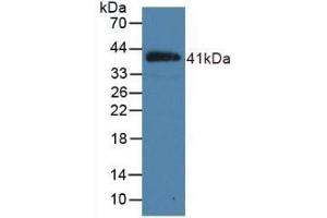 Detection of Recombinant NPPB, Porcine using Polyclonal Antibody to Natriuretic Peptide Precursor B (NPPB) (NPPB Antikörper  (AA 26-131))