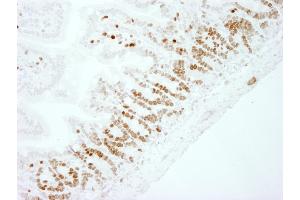 Immunohistochemistry (IHC) image for anti-Antigen Identified By Monoclonal Antibody Ki-67 (MKI67) (AA 1650-1700) antibody (ABIN7448620) (Ki-67 Antikörper  (AA 1650-1700))