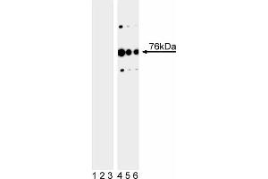 Western blot analysis of SLP-76 (pY113) in human T leukemia. (LCP2 Antikörper  (pTyr113))