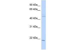 WB Suggested Anti-CIB3 Antibody Titration: 0.