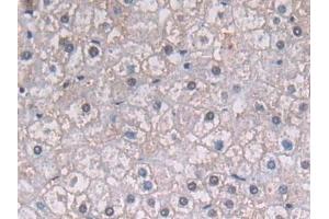 Immunohistochemistry (IHC) image for anti-Phosphoglycerate Kinase 1 (PGK1) (AA 2-417) antibody (ABIN7436240)