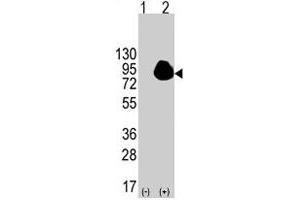 Western blot analysis of RPS6KA1 (arrow) using RPS6KA1 polyclonal antibody . (RPS6KA1 Antikörper  (Ser732))