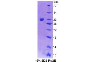 SDS-PAGE (SDS) image for Tec Protein Tyrosine Kinase (TEC) (AA 369-622) protein (His tag) (ABIN6239125) (Tec Protein Tyrosine Kinase (TEC) (AA 369-622) protein (His tag))