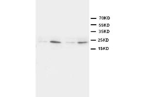 Anti-HMGB4 antibody, Western blotting Lane 1: Rat Brain Tissue Lysate Lane 2: Rat Testis Tissue Lysate Lane 3: JURKAT Cell Lysate Lane 4:  Cell Lysate