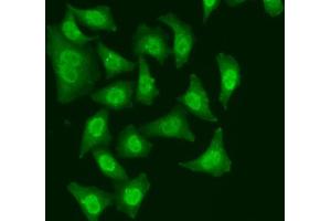 Immunofluorescence analysis of A549 cell using CDC5L antibody. (CDC5L Antikörper)