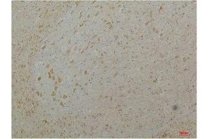 Immunohistochemistry (IHC) analysis of paraffin-embedded Mouse Brain Tissue using Cav1.